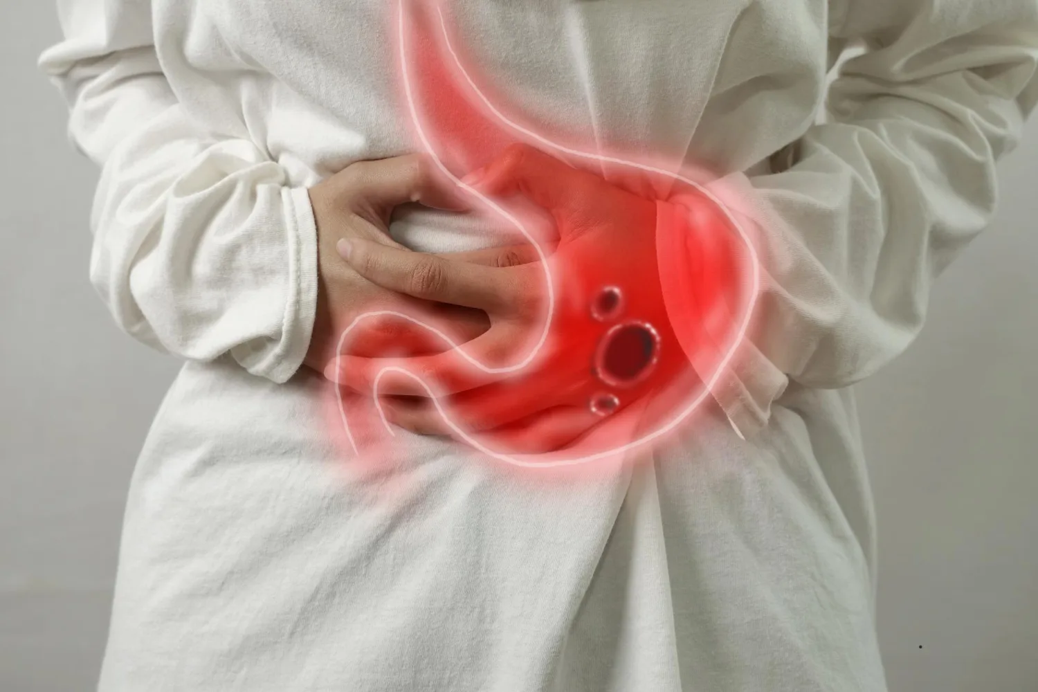 Tratamiento avanzado para la Enfermedad diverticular en CDMX y Edo. Mex.