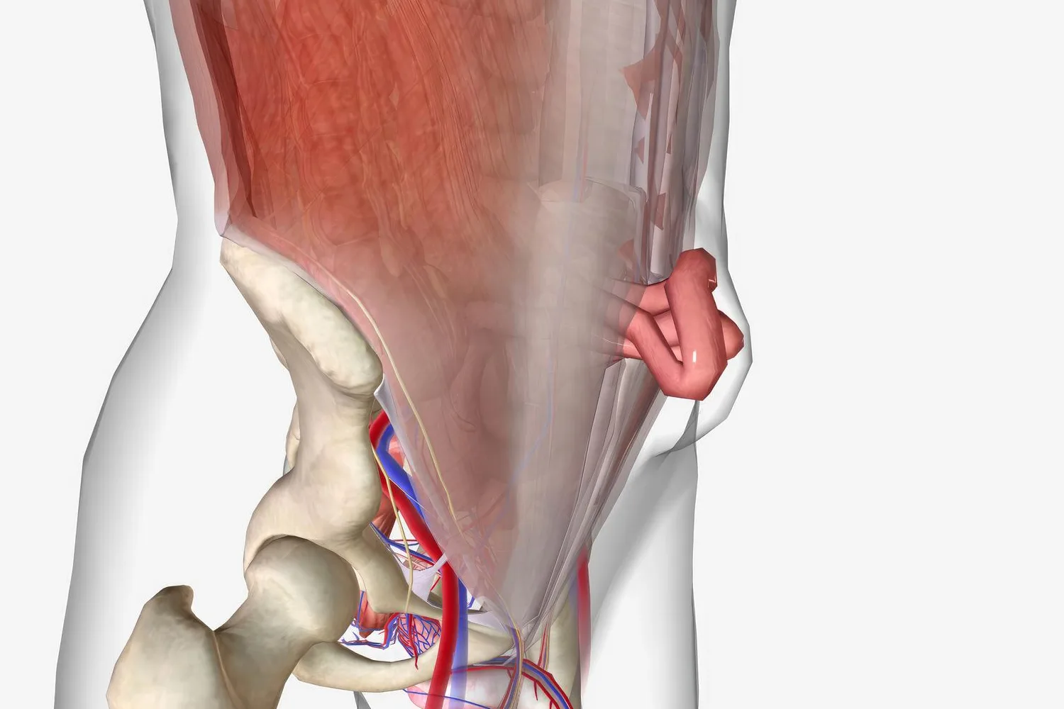 Tratamiento avanzado para hernia umbilical en CDMX y Edo. Mex. con cirugía de mínima invasión