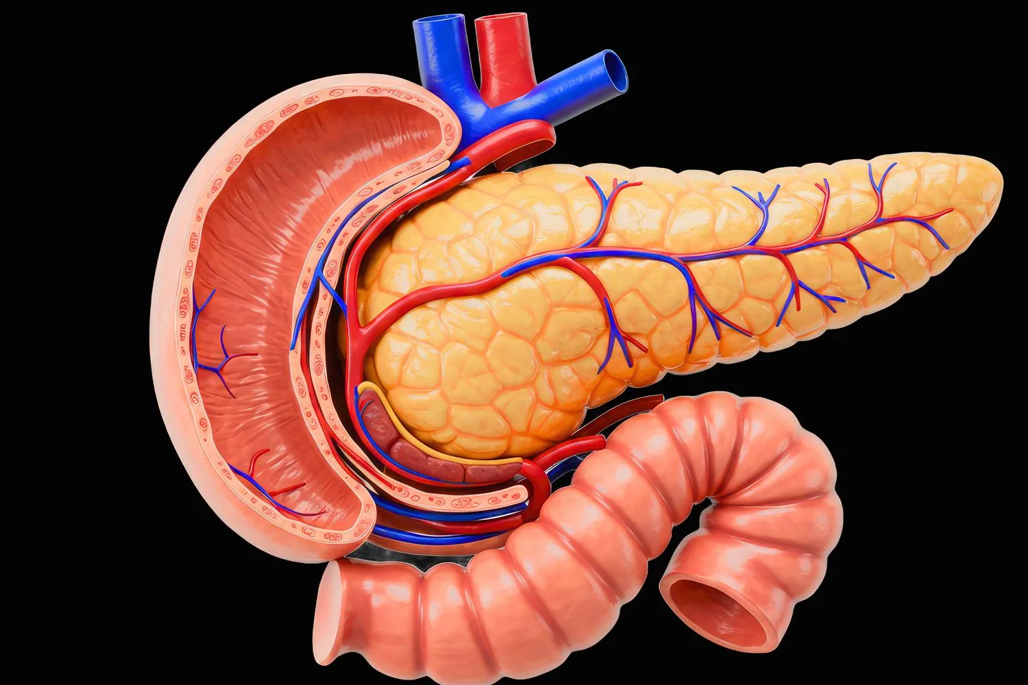 Pancreatitis en CDMX y Edo. Mex.: Tratamiento Avanzado con Cirugía de Mínima Invasión