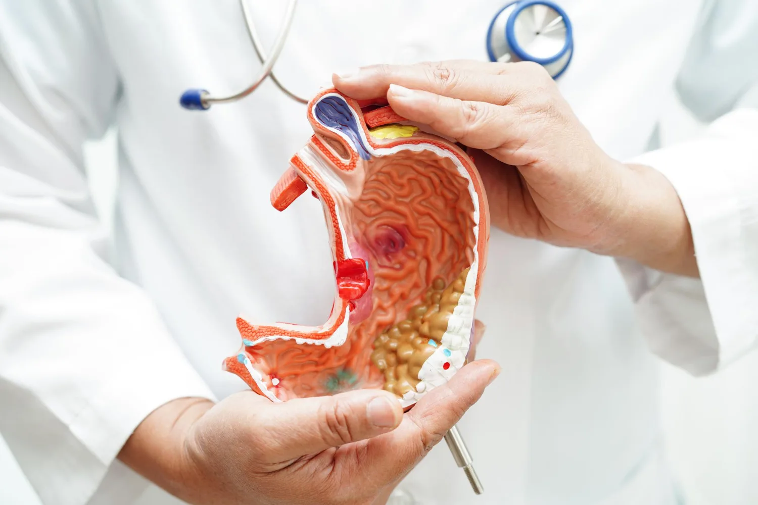 Resección intestinal en CDMX y Edo. Mex.: Cirugía avanzada para recuperar tu salud digestiva